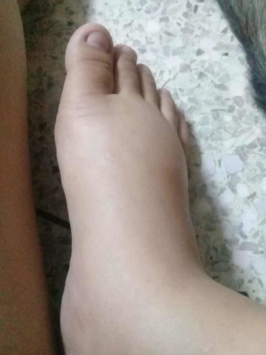 เสี่ยงครรเป็นพิษมั้ยค้ะ