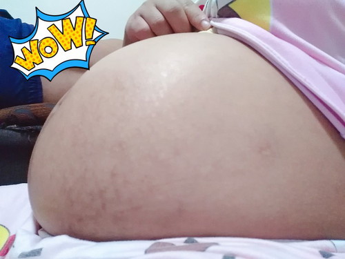 37w1d ท้องปั้นบ่อย