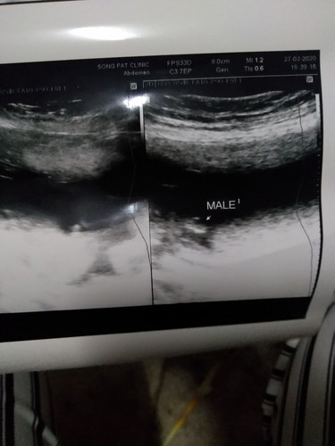 20W