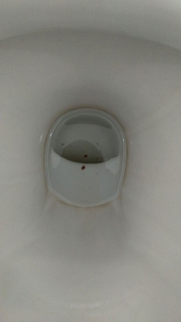 flek kehamilan week 6