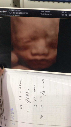 25 weeks