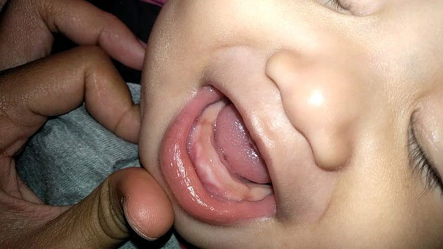 1 tahun belum tumbuh gigi