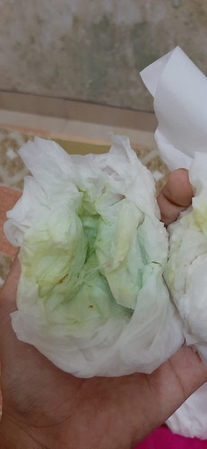 muntah berwana hijau dan kuning yang pahit usia kehamilan 8w