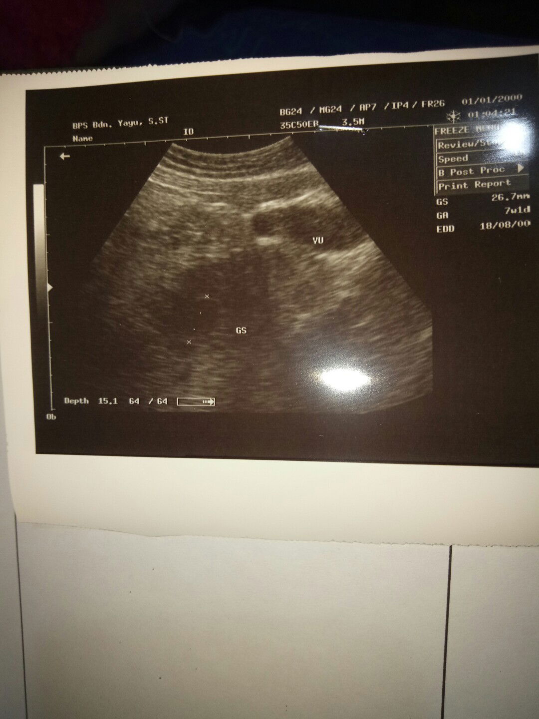 Janin 9w blm terlihat