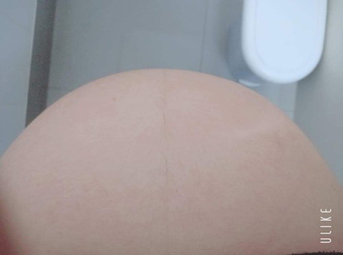 มีคุณแม่บ้านไหนที่มีโรคประจำตัวแล้วตั้งครรภ์