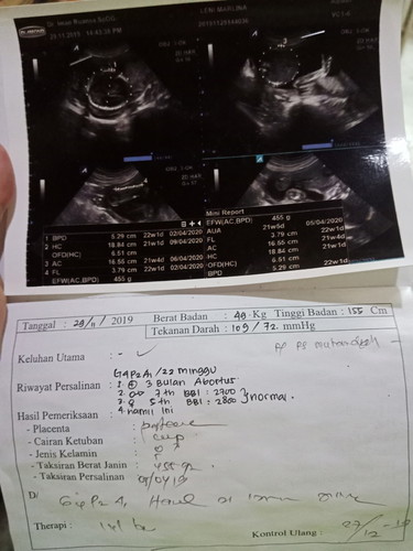 Usg Usia 5 Bulan