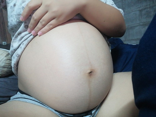 38+5แล้วท้องแข็ง