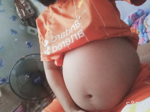 เจ็บสะดื้อ