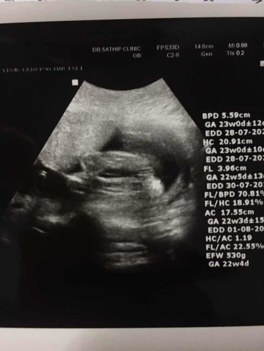 เพศหญิง??