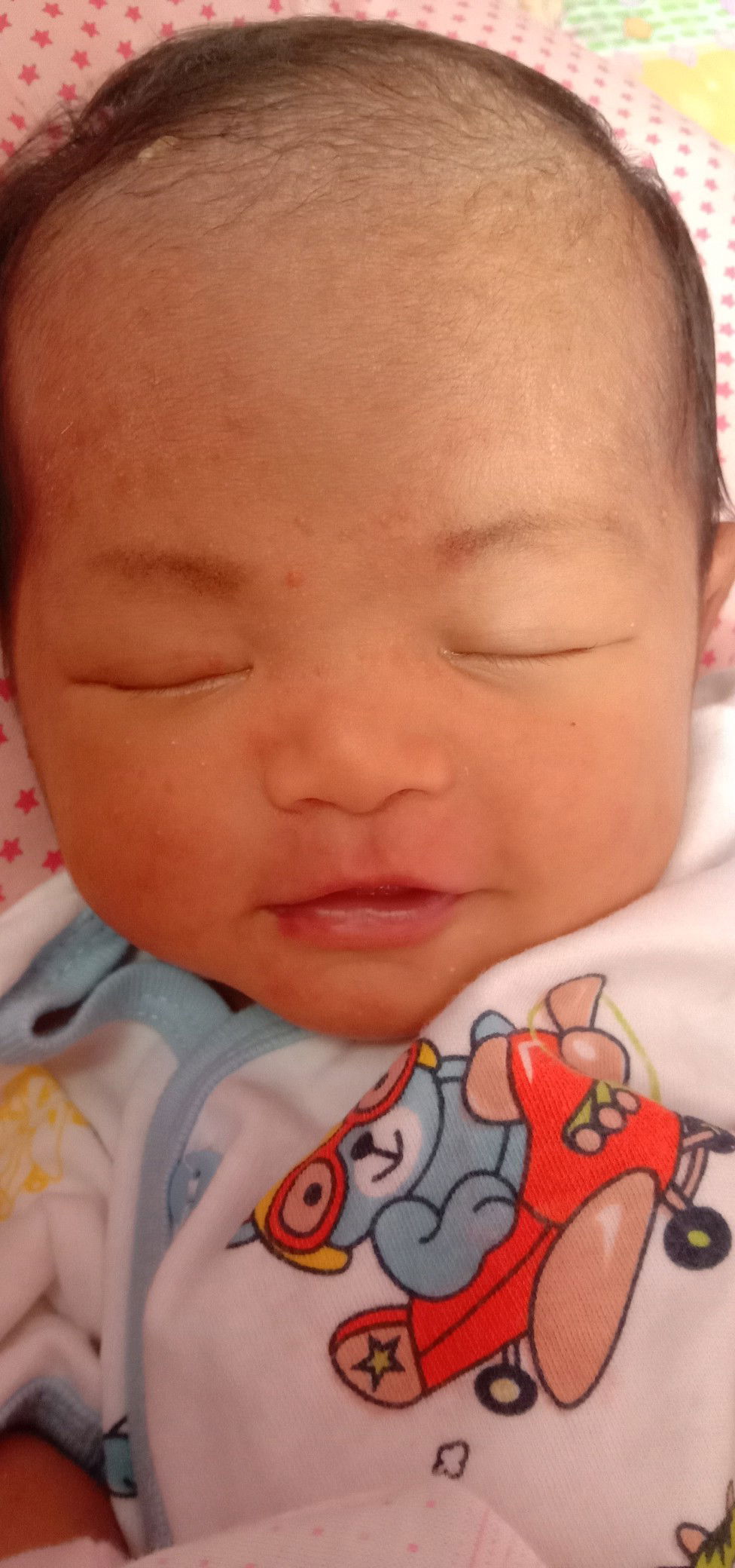 bintik merah pada bayi