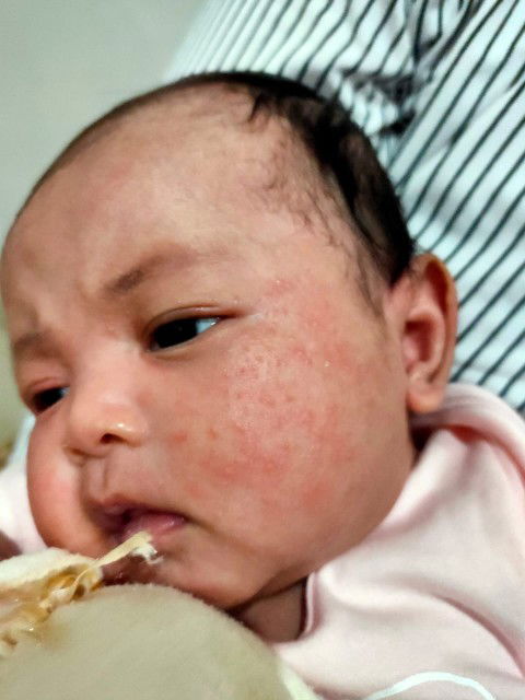 bintik merah di wajah