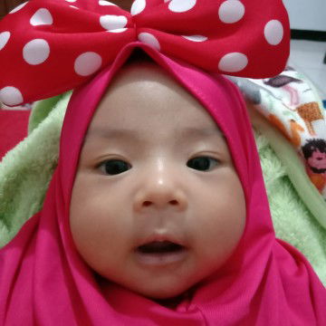 bekas air susu bisa menyebabkan bintik2