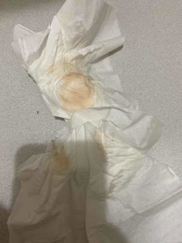 มีเลือดออก