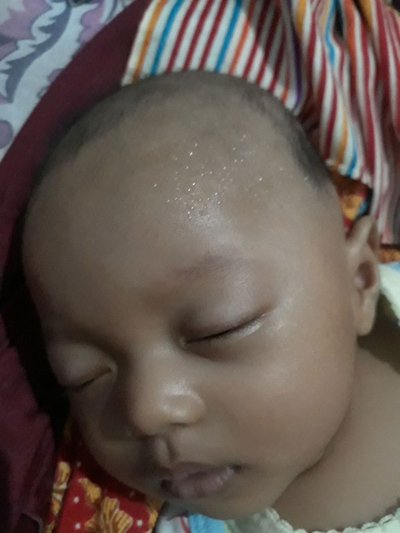 keringat bayi