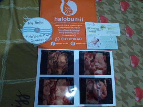 pengalaman USG di Halobumil