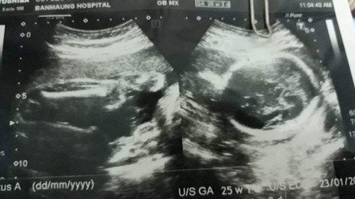 ดูไม่ออก