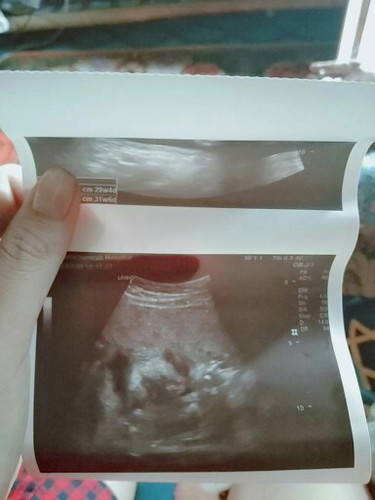 ต้นกล้า