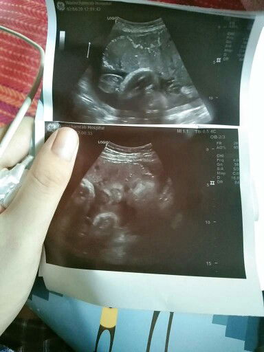 เอารูปน้องมาอวดคะ