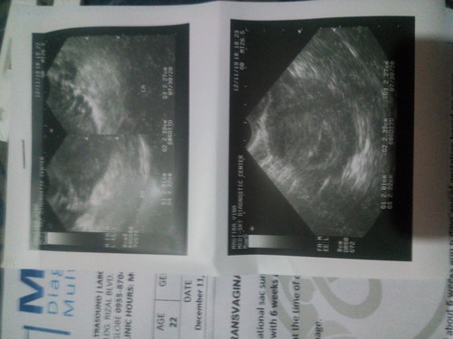 ultrasound