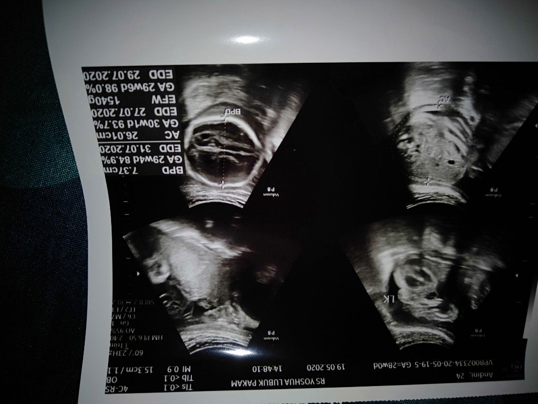 ada yg bisa bantu jelaskan bun?