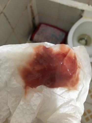 May dugo na lumabas