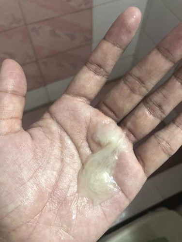 Mucus Plug?