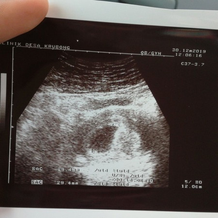 pregy 2bulan