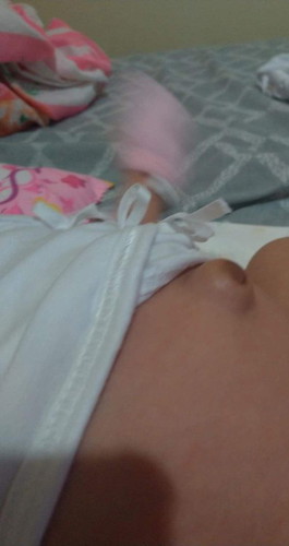 Umbilical Cord