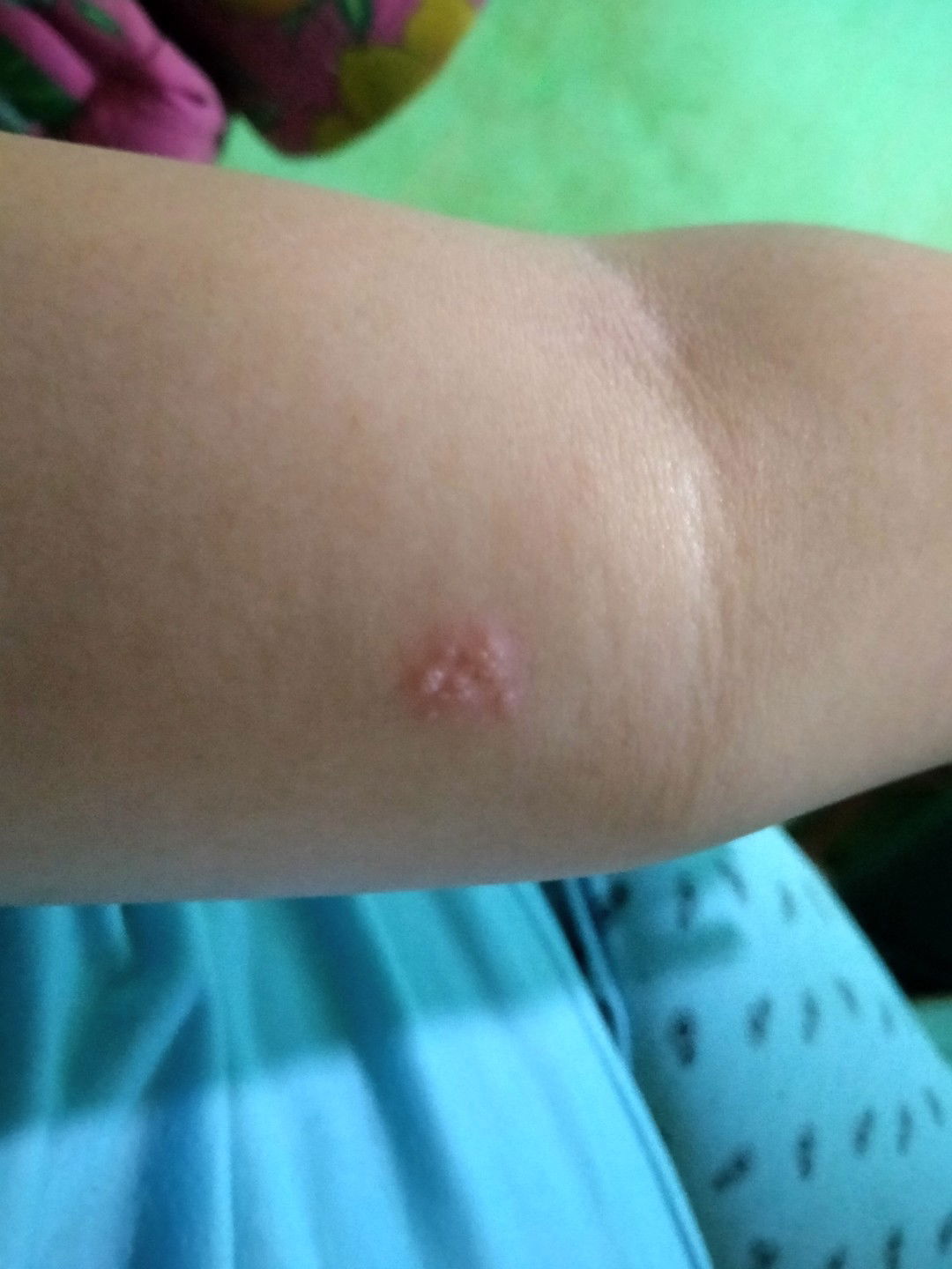 tolong jawab dong bun