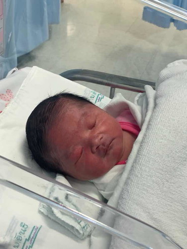 ลูกตัวแดง กับตาแดงๆยังงี้!!