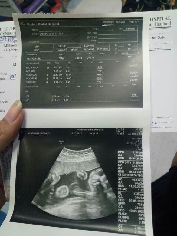 อยากทราบเพศ