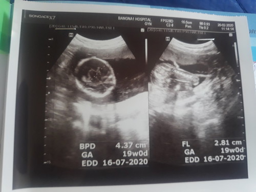 แบบนี้ชายหรือหญิงคะเพื่อนๆพอดูออกมั้ยคะ19W+