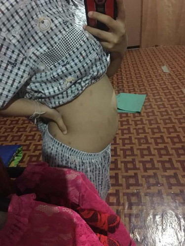 20 week 1 day