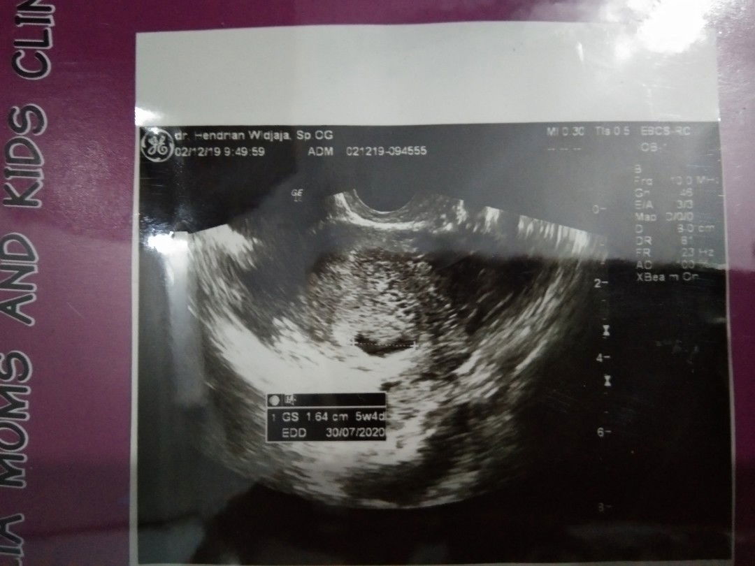 Mohon bantuan penjelasan nya Dok/Bu Bidan