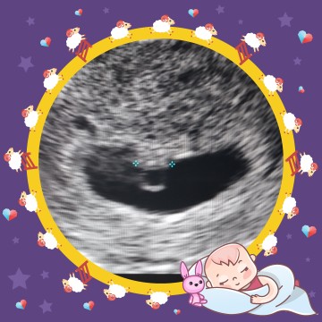 6W4D