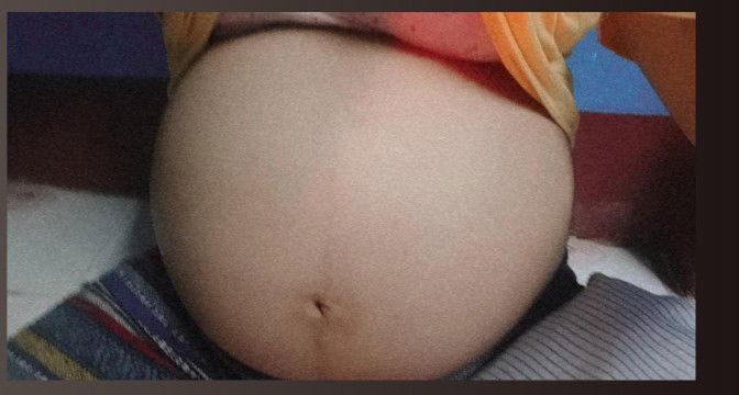 อายุครรภ์ 24สัปดาห์ กับกลิ่นบุหรี่