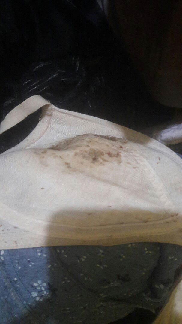 Masakit na nagtutibig at nagbabakbak ung suso