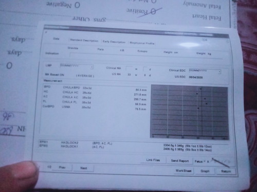 คือไม่รุ้จริงๆค่ะ