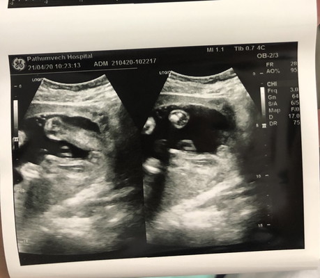 24 วีคแล้วค่ะ