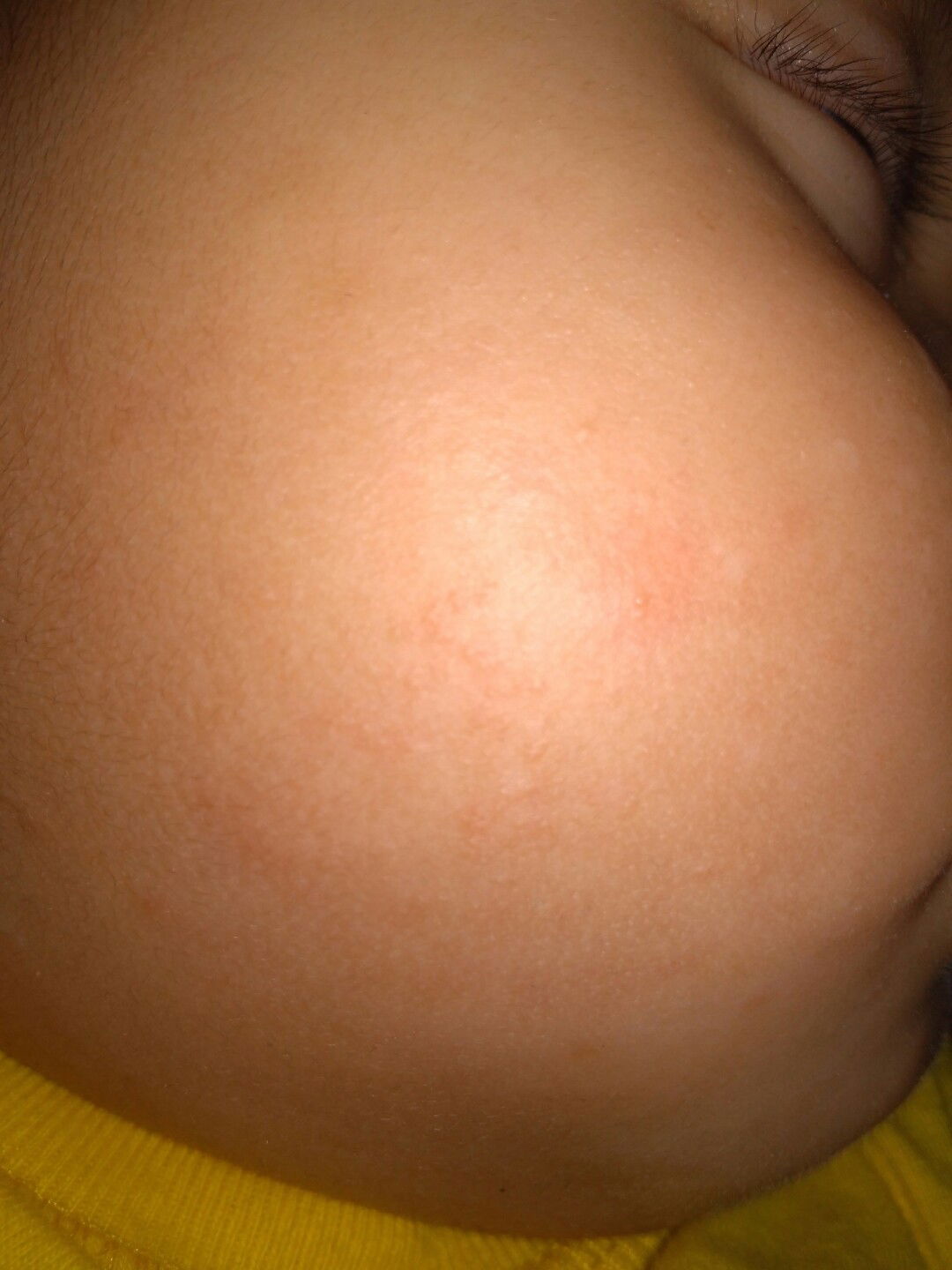 Brintis di pipi bayi