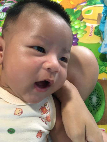ผม