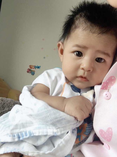 ใช้มือถูหน้าถูตาบ่อยมาก