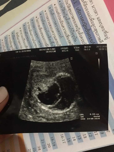 ใช่ภาวะแท้งคุกคามหรือเปล่าคะแม่ๆ