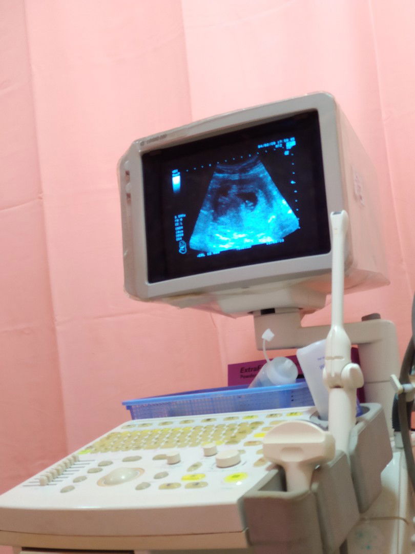 Kandungan Terancam (Threatening Miscarriage)