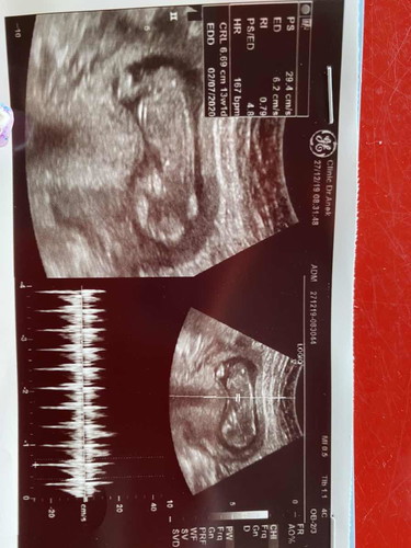 แม่ๆบ้านไหนคลอดเดือน กรกฎาคม 63 บ้างมั้ยคะ