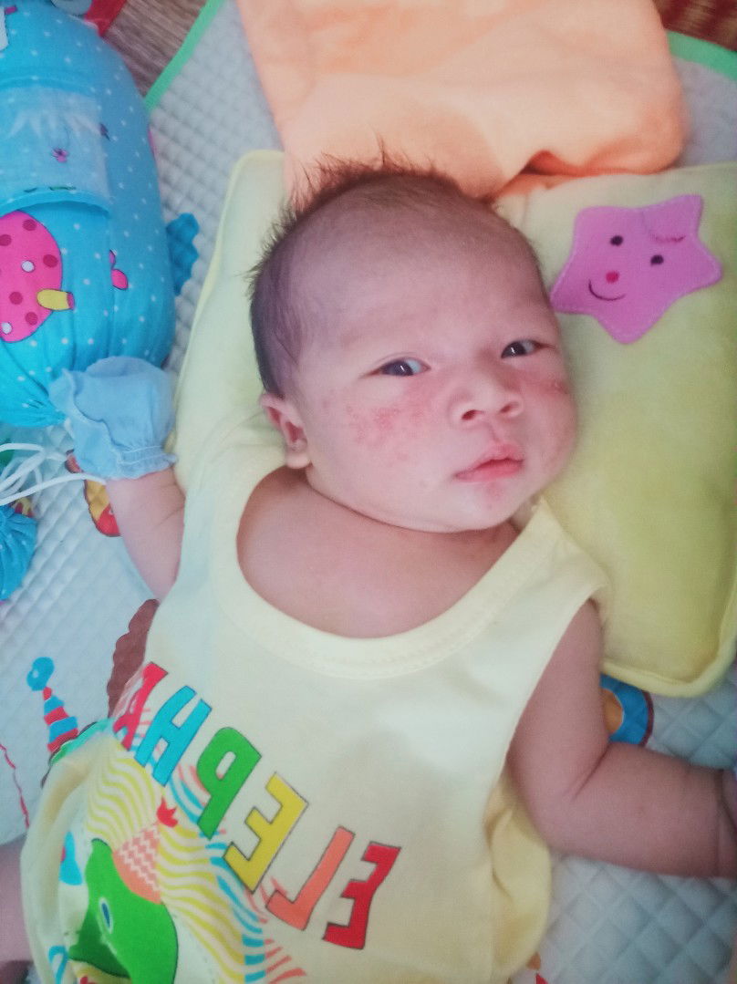 có m nào có bé bị như này k ạ làm cách nào để hết ạ