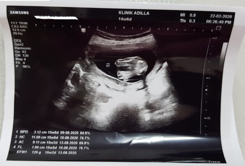 boy or girl??