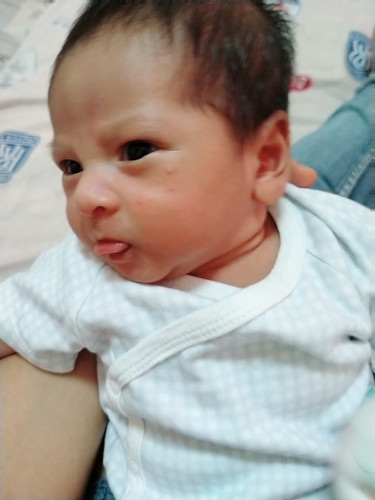 ผื่นแดง