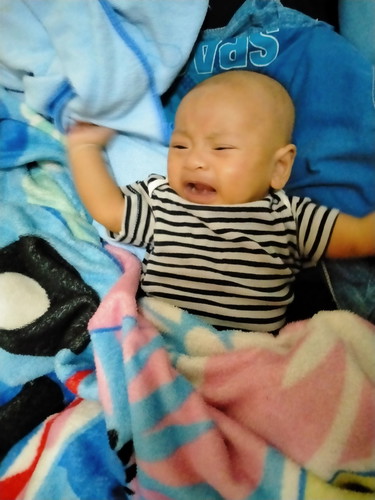 ฉีดวัคซีนแล้วมีไข้