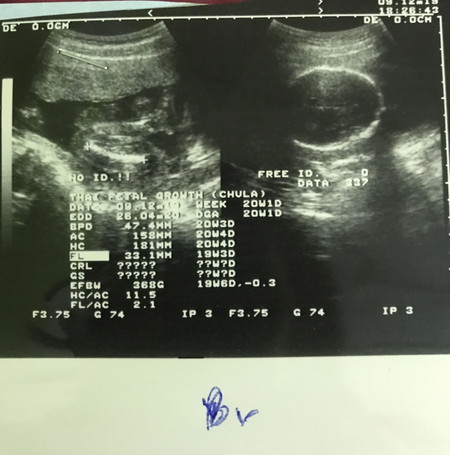 เห็นจู๋หรือจิ๋มค่ะแม่ๆ